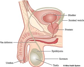 prostate cancer